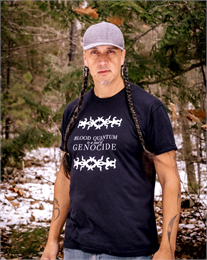 Photograph of Biskakone Greg Johnson wearing a grey baseball cap and block "Blood quantum is a tool of genocide" t-shirt